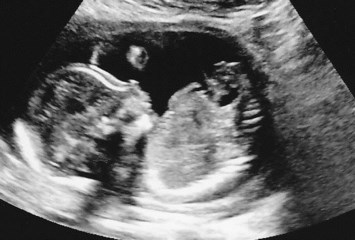 Obituary of Hadley Elaine Stone