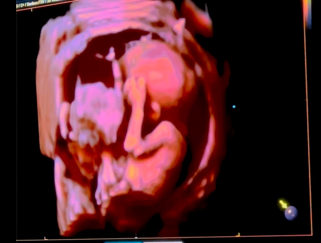 Obituary of Katharina Elena Gonzalez Tarin