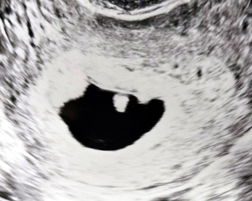 Obituary of Pazlie Lillian Grace Dishman