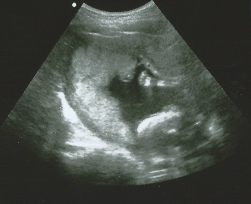 Obituary of Jarve A'mauri James Collier