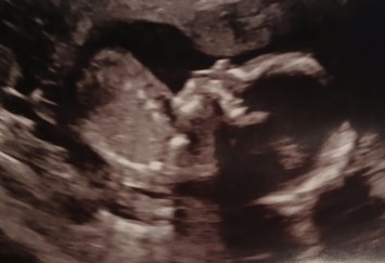 Obituary of Mateo Mendez