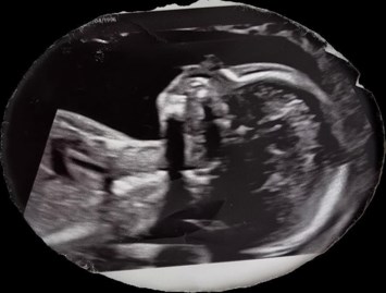 Obituary of Jade Aguirre