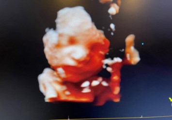 Obituario de Amellia Elizabeth Sanchez