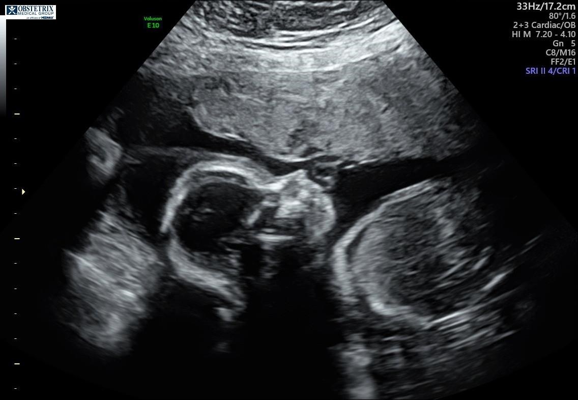 Obituary of Mateo Jay Duenas